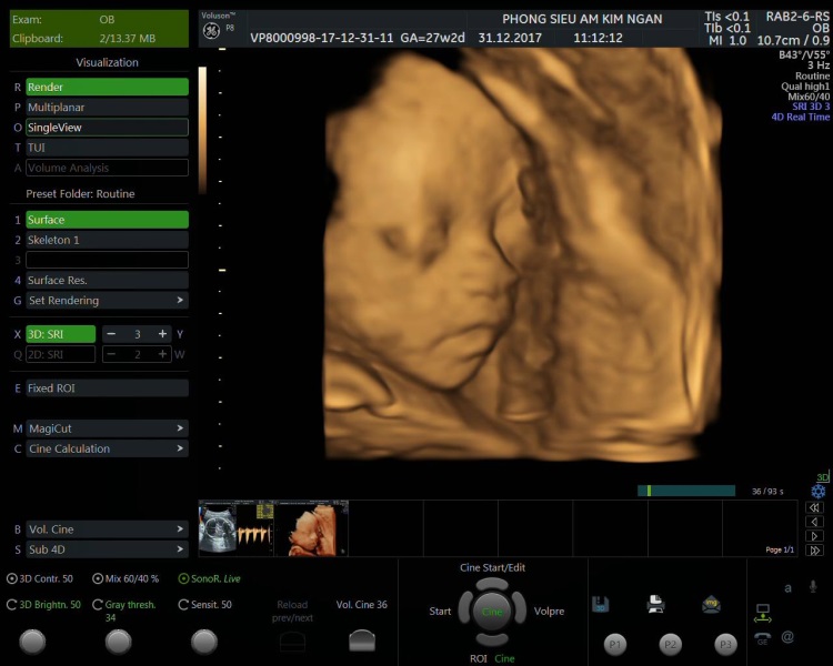 Seri ảnh các giai đoạn phát triển của thai