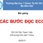 Các bước đọc điện tim ECG – ĐHYD TP Hồ Chí Minh