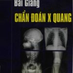 [PDF] Bài giảng chẩn đoán X quang, Phạm Ngọc Hoa