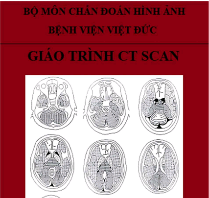 Giáo trính CT SCAN – ĐHYD Hà Nội