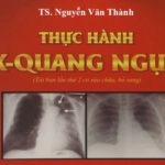 Thực hành X quang ngực, Nguyễn Văn Thành