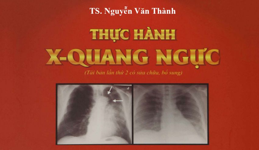 Thực hành X quang ngực, Nguyễn Văn Thành