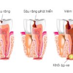 Bệnh học răng miệng – TS Nguyễn Toại – ĐHYD Huế