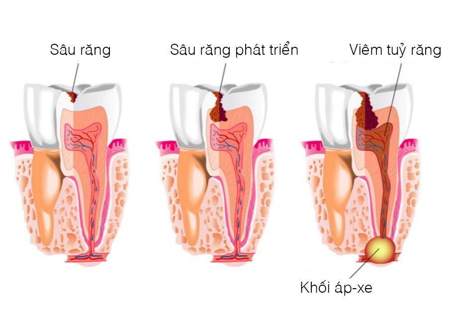 Bệnh học răng miệng – TS Nguyễn Toại – ĐHYD Huế