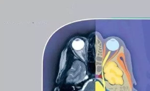 Giải Phẫu Cắt Lớp CT-MRI (Cuốn 1: Phần Đầu – Cổ)